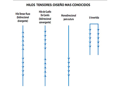 Hilos Tensores